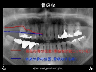 饤04