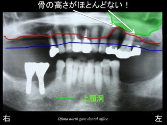 饤17