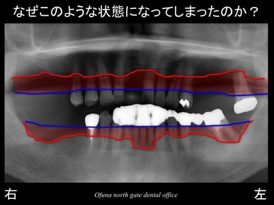 饤09