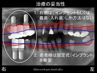 饤11