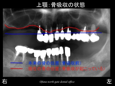 饤18