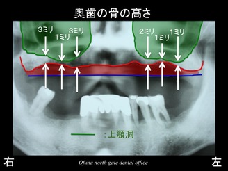 饤06