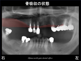 饤03