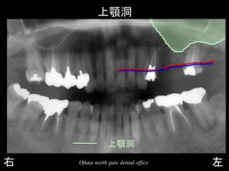 饤18