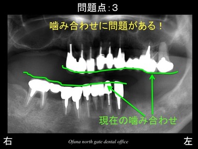 饤07