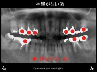 饤08