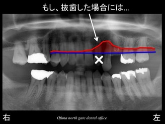 饤13