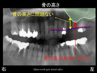 饤19