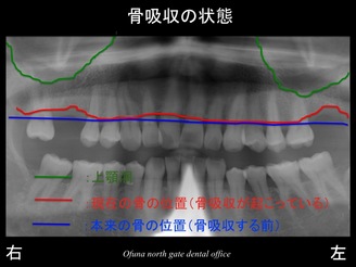 饤4