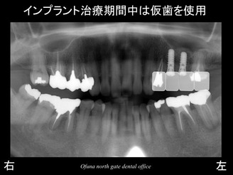 饤22