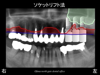 饤27