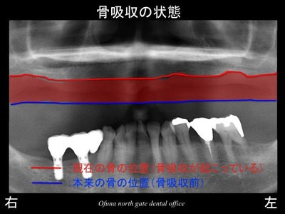 饤04