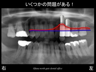 饤19