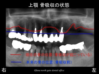 饤20