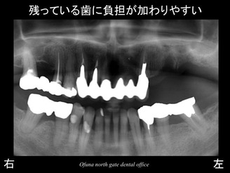 饤16