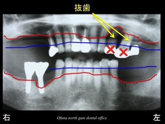 饤10