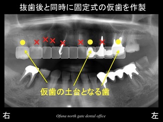 饤1