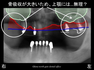 饤09