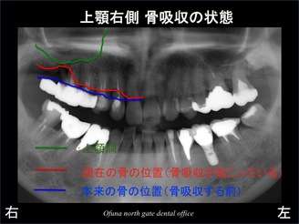 饤09