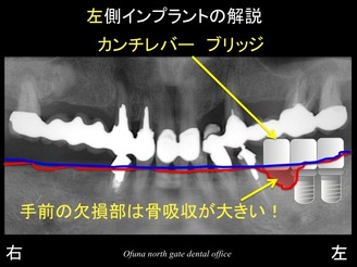 饤14