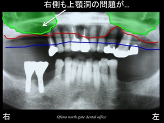 饤19