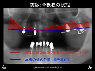 饤06