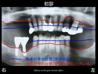 饤08