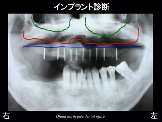 饤04