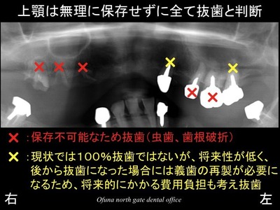 饤18