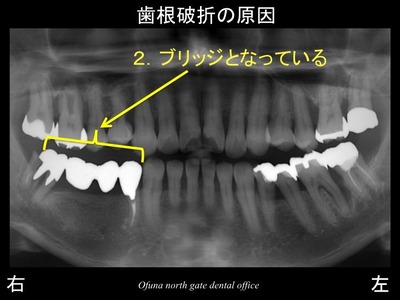 饤08