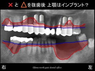 饤08