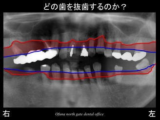 饤05