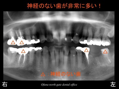 饤05