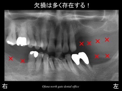 饤15