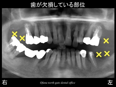 饤05