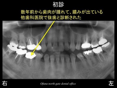 饤11