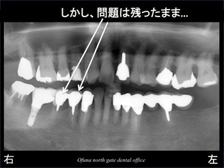 饤11