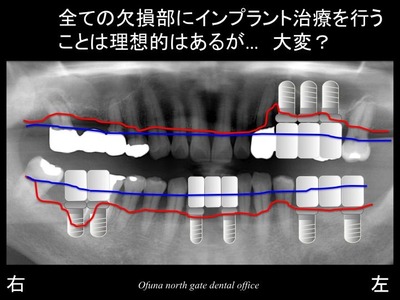 饤6