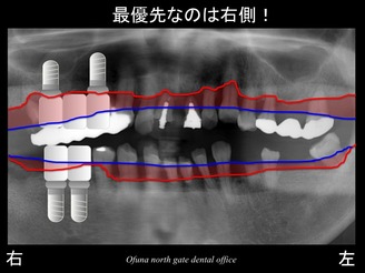 饤22