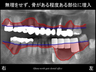 饤12