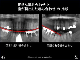 饤06