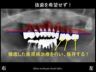 饤11