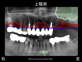 饤23