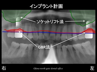 饤6