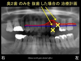 饤10