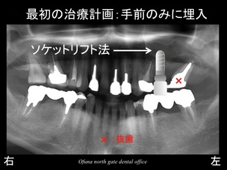 スライド04