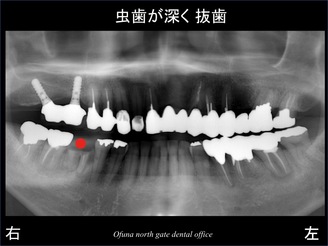 饤14