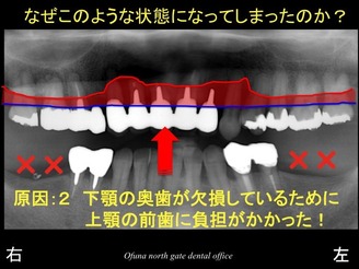 饤08