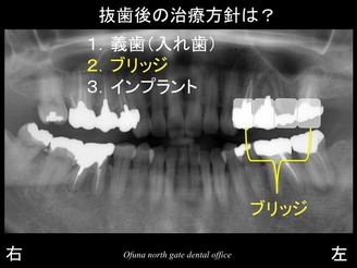 饤11