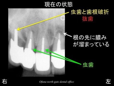 饤10